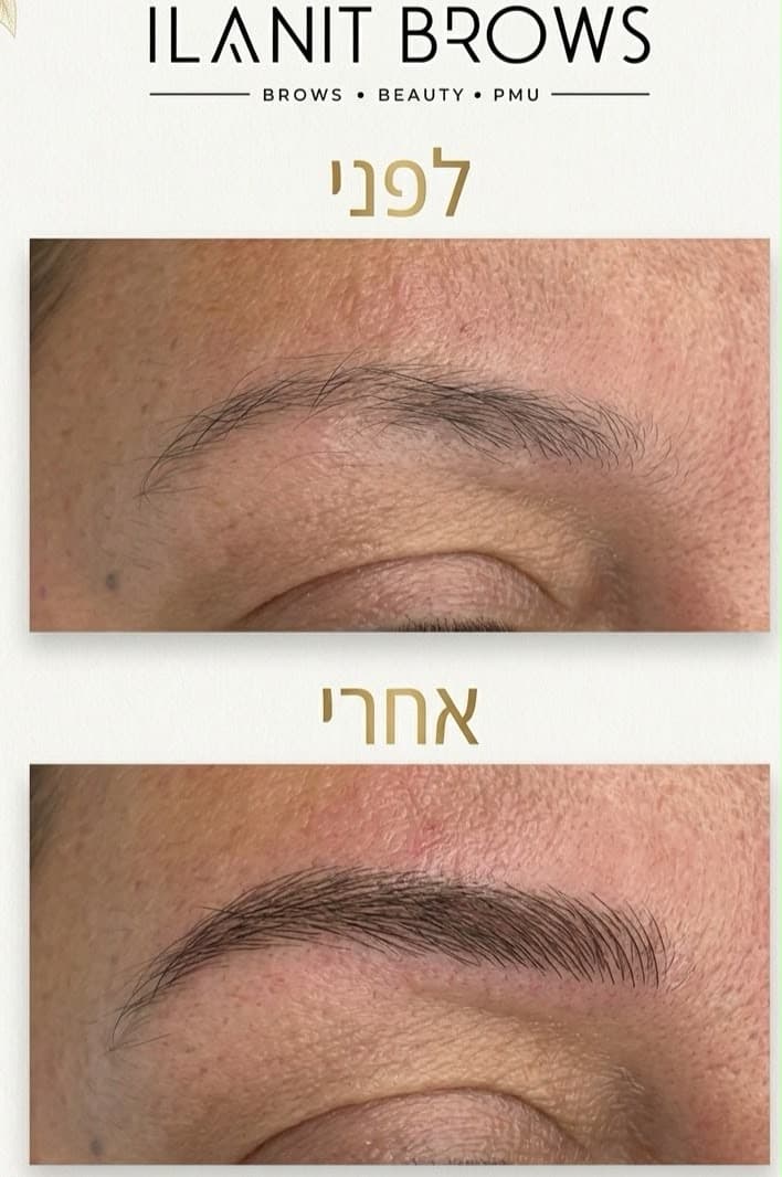 מיקרובליידינג — עבודה 5
